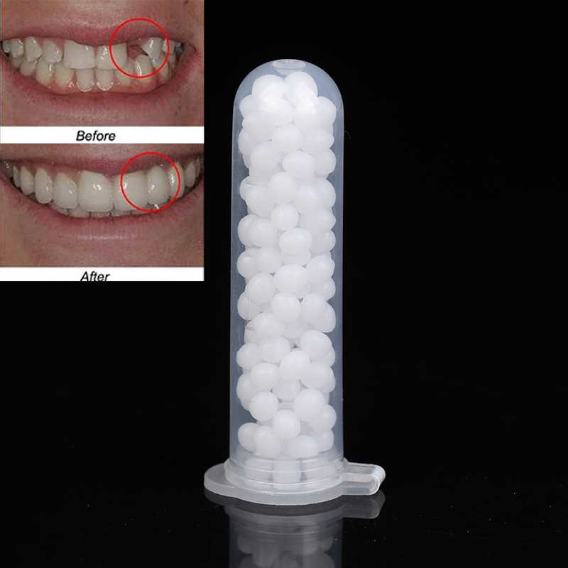 【K】1 caixa de kit de reparo te - Teeth Whitening Kit avaliação e preço