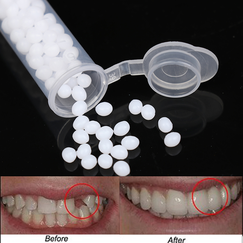 【K】1 caixa de kit de reparo te - Teeth Whitening Kit avaliação e preço