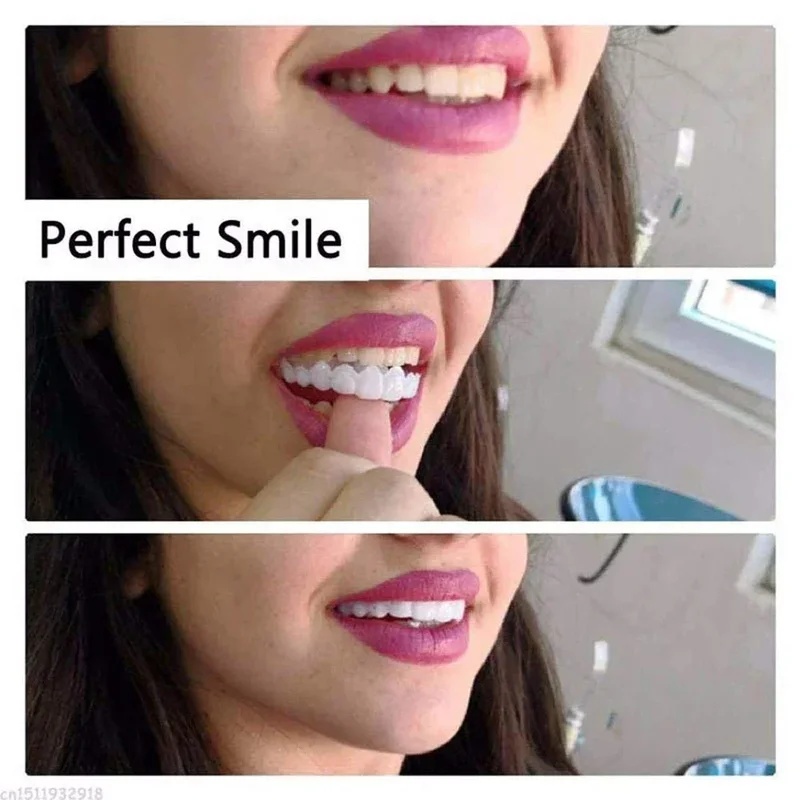 Kit de Dentes de Faceta Snap-o - Teeth Whitening Kit avaliação e preço